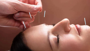 Facial Rejuvenation Acupuncture in Korea: Jeonganchim Works From the Inside Out