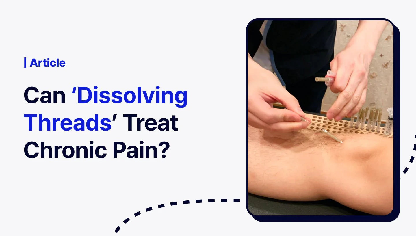 Can ‘Dissolving Thread Embedding’ Treat Chronic Pain? – Tong-in Clinic